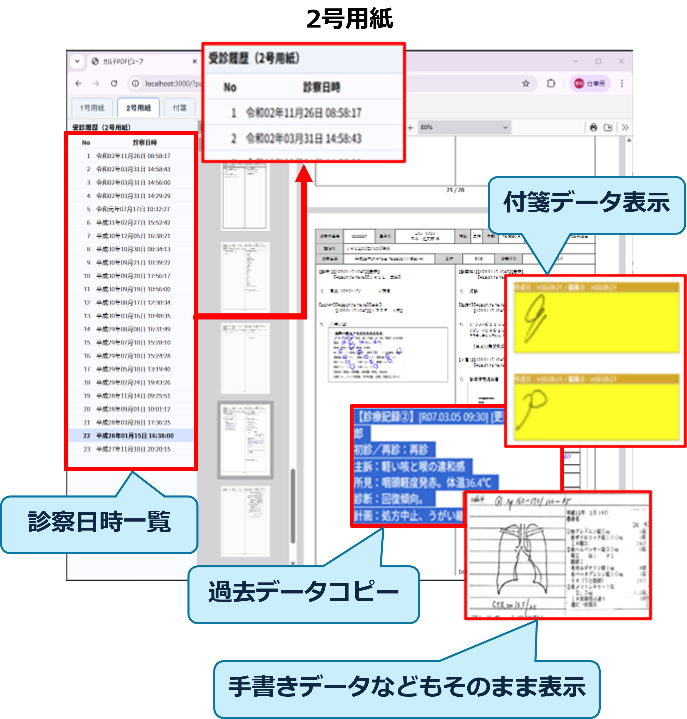 カルテビューア表示イメージ（2号用紙・付箋データ表示）